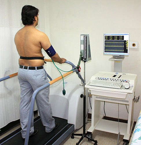 Patient undergoing a TMT Test in Bhopal while walking on a treadmill, connected to monitoring equipment for cardiac assessment.